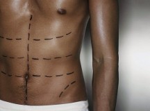 Plastic Surgery Expectations by Men