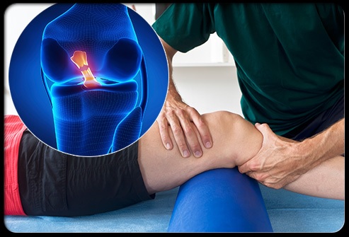 ACL Injury: Is Surgery Required?