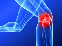 ACL Injury: Is Surgery Required?