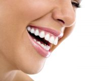 Benefits Of Cosmetic Fillings