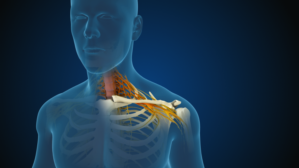 What Is Cervical Radiculopathy What Are The Treatment Options